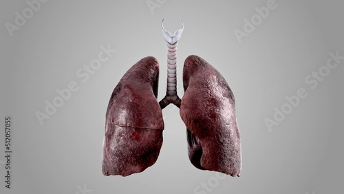 Realistic 3d animation of human lungs progress stages from healthy to sick smoker lungs. High quality 4k footage