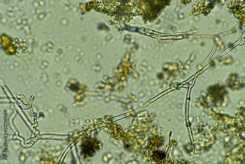 Fungal and fungi hyphae under the microscope in the soil and compost, in a soil biology and microorganism test in Australia. photo