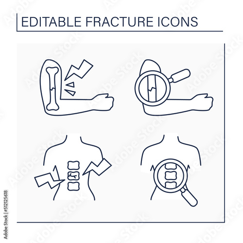 Fracture line icons set. Bone diagnostic and treatment. Healthcare concept. Isolated vector illustrations. Editable stroke