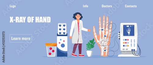 Rheumatoid arthritis of the hand. Tiny doctors treat rheumatism, osteoarthritis, make ultrasound, x ray.