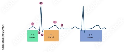 ECG image show normal ECG with waves and intervals 
