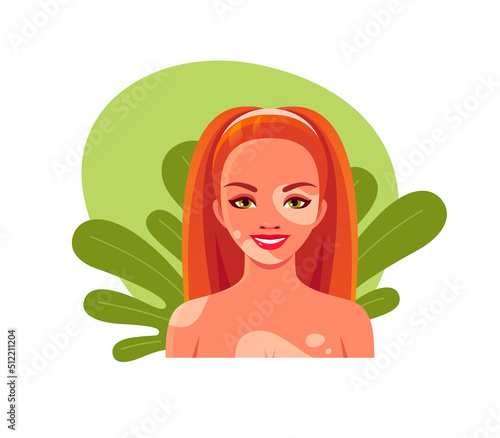 Portrait of happy woman with vitiligo. Diverse female character with skin losing pigment. Vector cartoon avatar of happy girl with depigmentation patches on body on leaves background