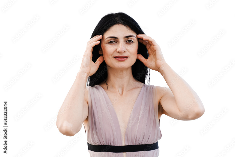 Tender woman with vitiligo pigmentation patches on hands on white background. Lifestyle with skin seasonal diseases. Tender woman with vitiligo pigmentation patches on hands on white background. Lifestyle with skin seasonal diseases.
