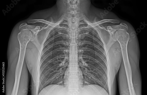 Tableau sur toile X-ray images of body isolated on white background.