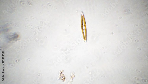 freshwater diatom, magnification x400, silicean, algae photo