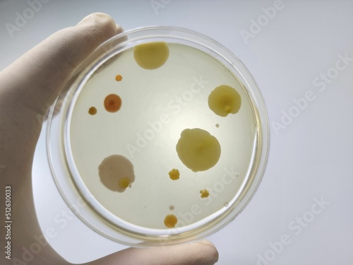 Фотография Microbial culture result confirmation photo