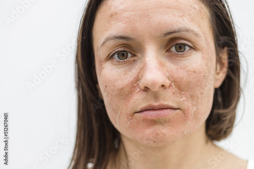 Cropped photo of woman with dry skin over white background.