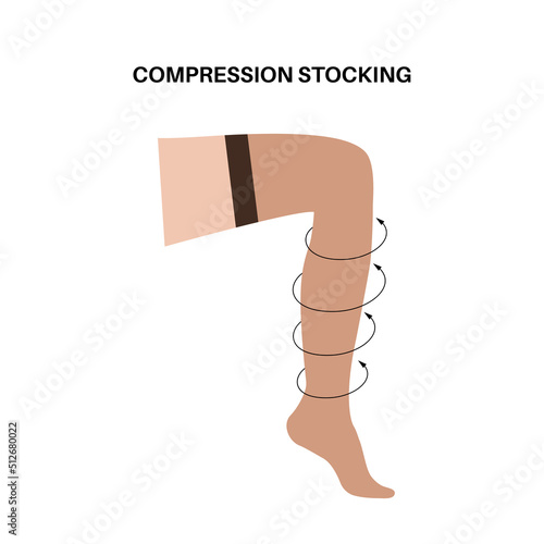 Compression stocking pressure