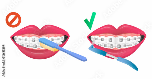 Vector isolated image of instructions to rule of right and false brush teeth with dental braces, retainer. Concept tooth care, braces and chosen toothbrush. You can used in web design, postcard, etc