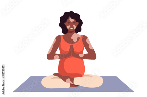Happy pregnant woman with vitiligo doing yoga