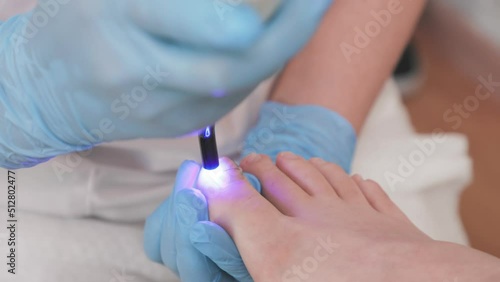 Wallpaper Mural Chiropodist installs a titanium thread on the big toe and using UV gadget. Correction of ingrown toenail. Pan shot. The concept of podology, orthopedics and chiropody. Torontodigital.ca