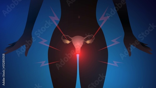 Silhouette of a woman with uterus and gynecological disease, pain in the vagina