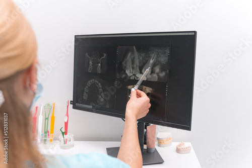 Female dentist is pointing at the screen with radiology film of some teeth.