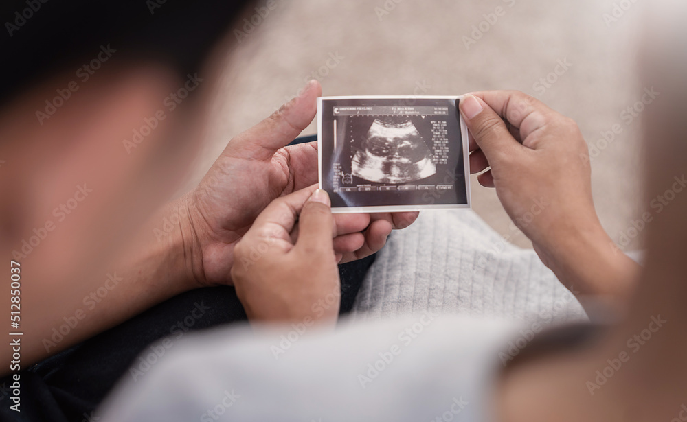 Asian or caucasian pregnant woman and husband holding ultrasound 4d scan image, Expectation of a child and Maternity prenatal care.Parenthood, bonding together, woman pregnancy concept banner Asian or caucasian pregnant woman and husband holding ultrasound 4d scan image, Expectation of a child and Maternity prenatal care.Parenthood, bonding together, woman pregnancy concept banner