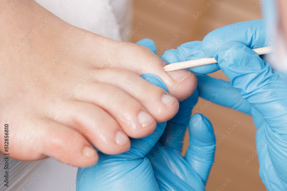 pedicure master processes the cuticle on the toes with a wooden stick pedicure master processes the cuticle on the toes with a wooden stick