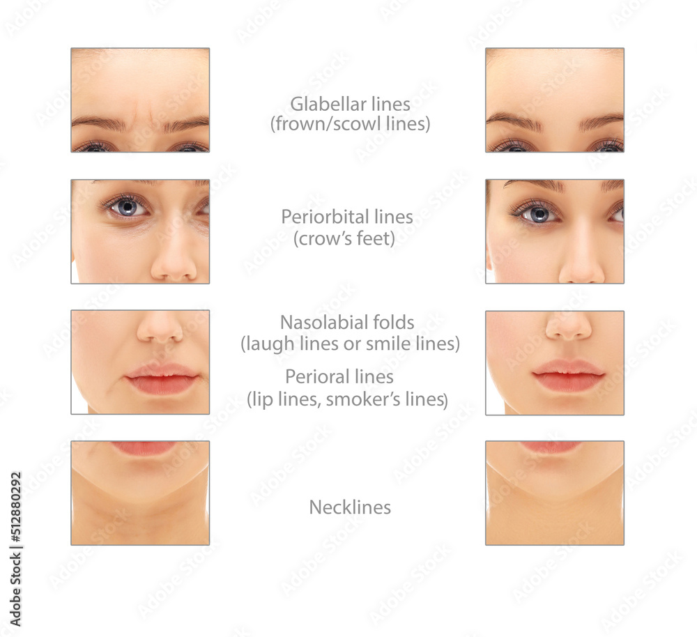 Ageing skin ,internal and external causes of skin aging, signs of skin ...