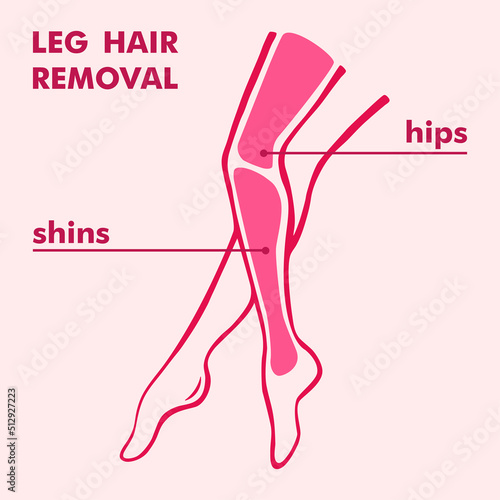Hair removal from the hips and shins. Depilation zones of the legs. Wax, sugar and laser hair removal of the female body. Flat style. Illustration for beauty salons. 