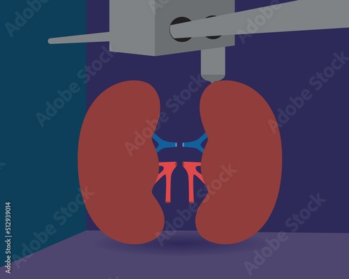 Kidney organ in 3D printer, flat vector stock illustration as concept of medical and health care technologies