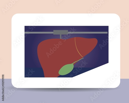 Organ liver in 3D printer, flat vector stock illustration as concept of medical and health care technologies