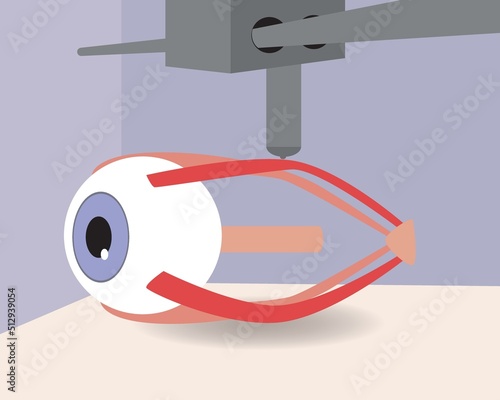 Eye organ in 3D printer, flat vector stock illustration as concept of medical and health care technologies