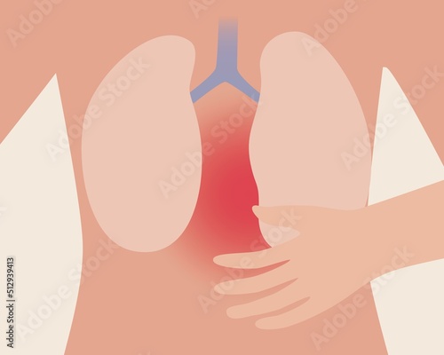 Lung disease, anatomical vector stock illustration with person and disease bronchitis or pneumania