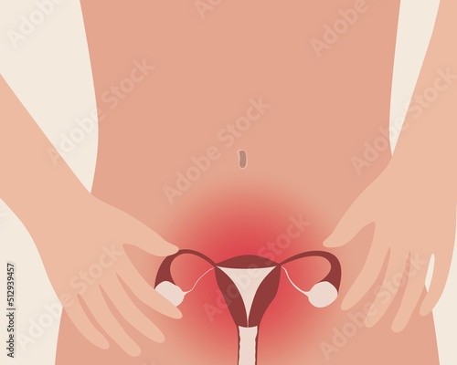 Pain during menstruation, anatomical vector stock illustration with uterus and fibroid disease