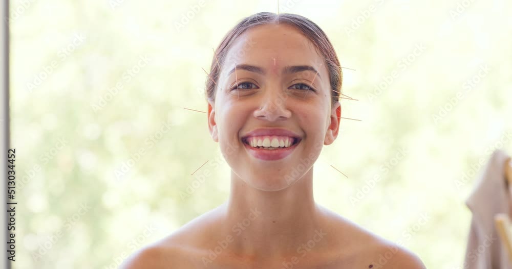 Portrait of woman with acupuncture needles in her face in front of a window. Closeup of a happy Latin female patient smiling in a health clinic getting traditional facial beauty treatment Portrait of woman with acupuncture needles in her face in front of a window. Closeup of a happy Latin female patient smiling in a health clinic getting traditional facial beauty treatment