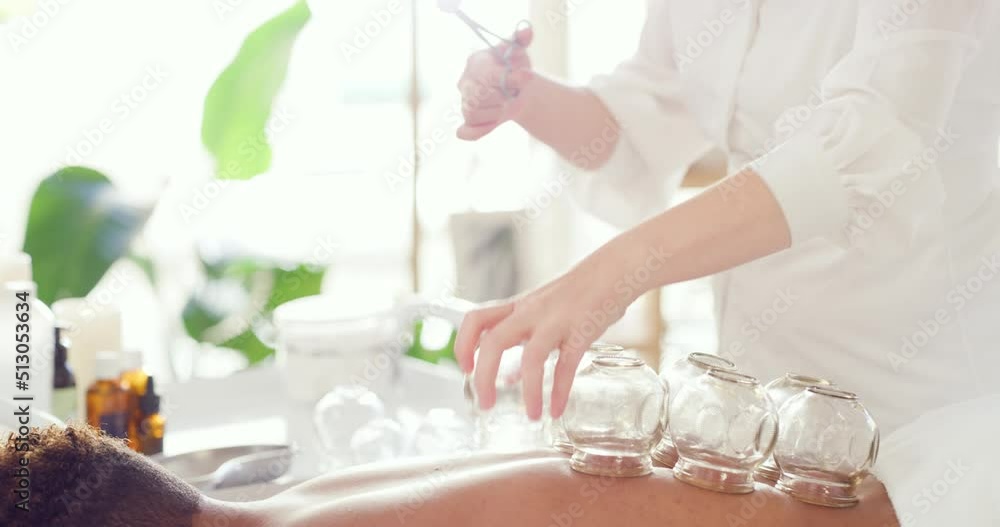 Closeup of a therapists hands placing suction cups on a clients back. Cupping therapy is alternative medicine to help with pain, inflammation, blood flow, relaxation and wellness, deep tissue massage Closeup of a therapists hands placing suction cups on a clients back. Cupping therapy is alternative medicine to help with pain, inflammation, blood flow, relaxation and wellness, deep tissue massage