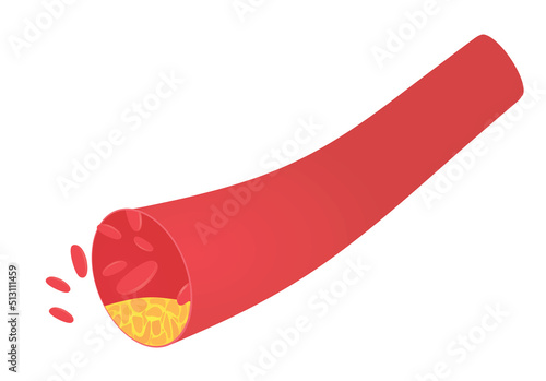 Vascular blood artery. vector illustration