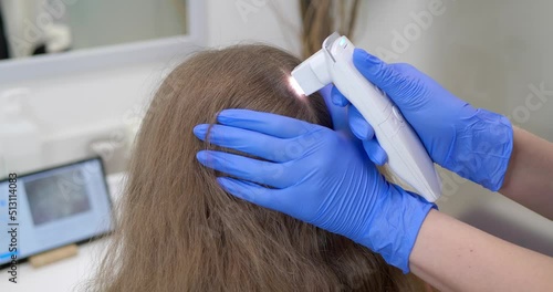 Trichologist working with client at personal office, closeup. Examining scalp using dermatoscope photo