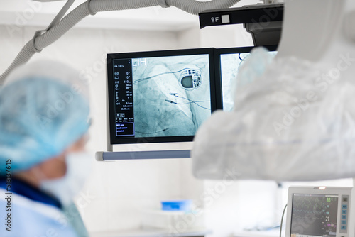 the surgeon observes on x-ray monitors, an implanted pacemaker connected to the heart. cardiovascular surgery. the monitors show the results of the operation to connect the pacemaker