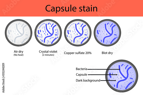 Capsule staining microbiology lab technique steps diagram, using Crystal violet and copper sulfate vector illustration eps10