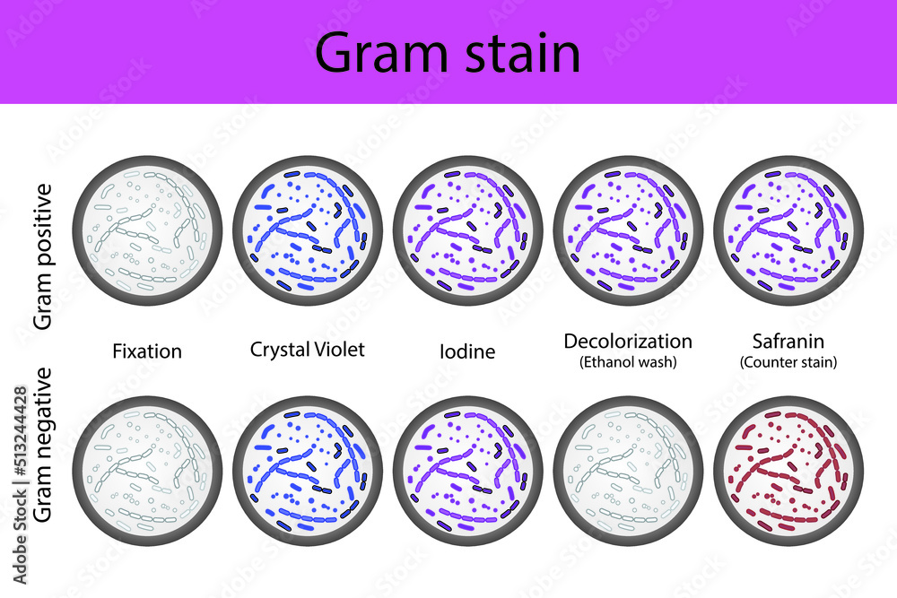 Diagram showing gram staining microbiology lab technique steps microbiology laboratory using