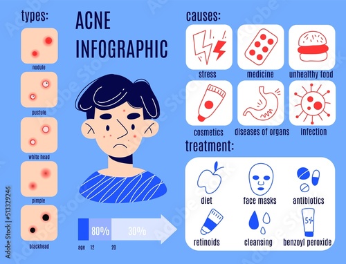 Man problem skin infographic. Stop acne educational poster. Causes, prevention and treatment, sad guy with facial pimples, doodle style character. Swanky cartoon flat style isolated concept
