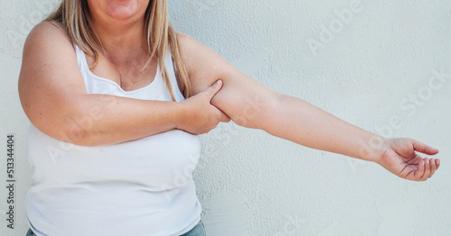 Woman with flabby belly and thick sides showing flabby arms. Sudden weight gain.