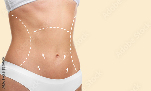 Beautiful young woman in underwear on light background, closeup. Concept of plastic surgery photo