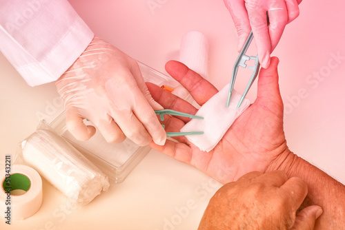 Obraz na płótnie Doctor doing wound dressing care and bandaging patient's hand, Hand surgery treatment, Nurse treat patient's finger injury in hospital. w salonie