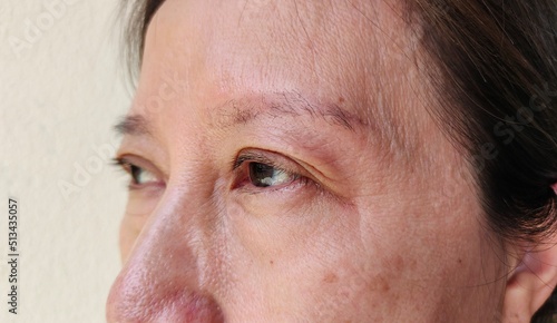 close up portrait showing the flabbiness and wrinkle beside the eyelid, problem blemish on the face of the woman, concept health care.