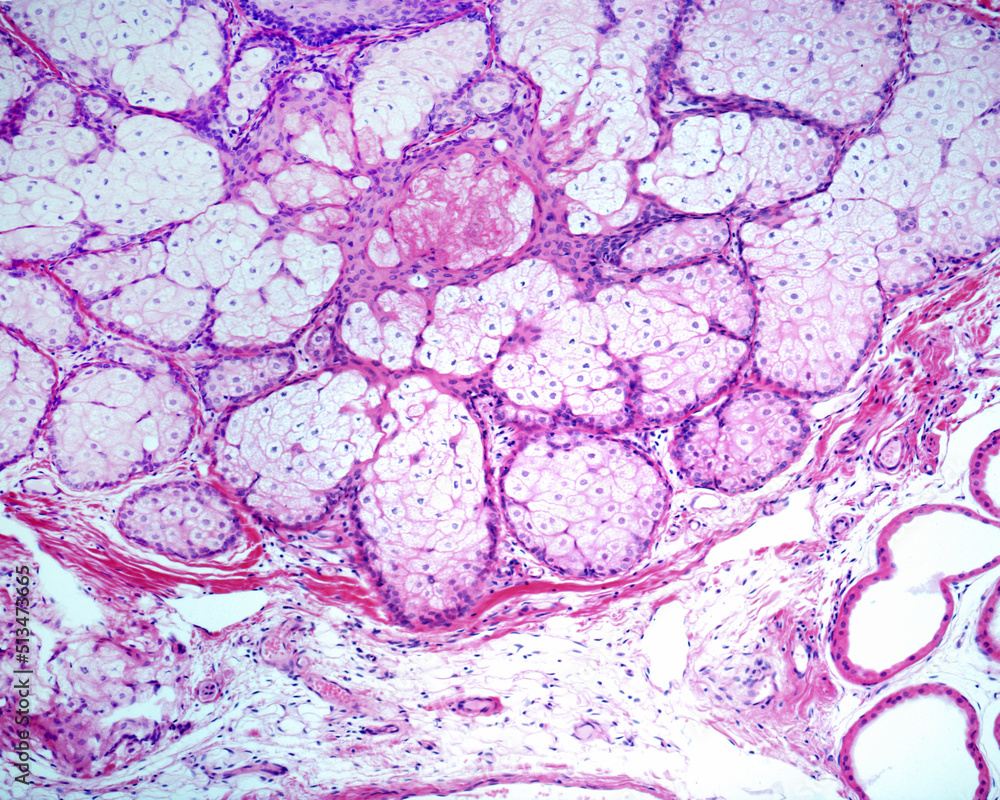 Human sebaceous gland Stock Photo Biology Diagrams