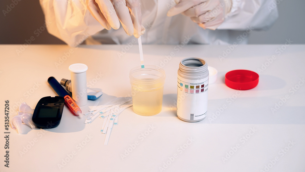 Medical laboratory diagnosing of ketonuria by using ketone screening