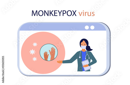 Monkeypox symptoms concept cartoon vector illustration.