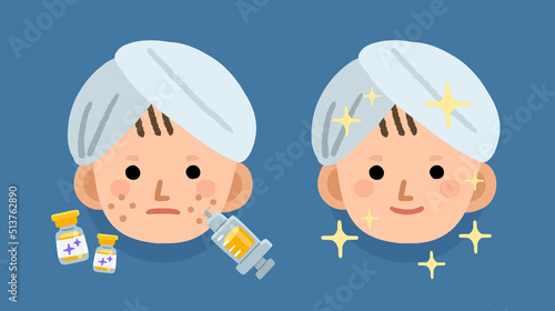 woman with medical face treatment for clear acne problem