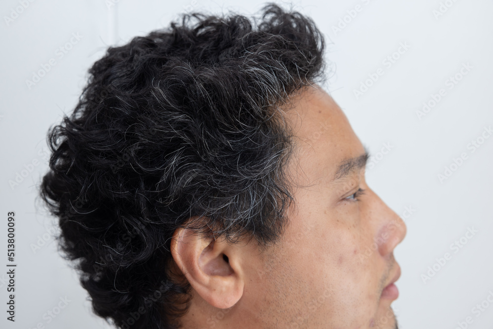 Fototapeta premium Young Asian Man with Premature Grey Hair Pronblem