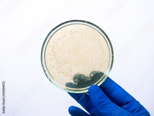 Close-up, the hand of a scientist in a blue glove holds a petri dish with small colonies of bacteria on a white background