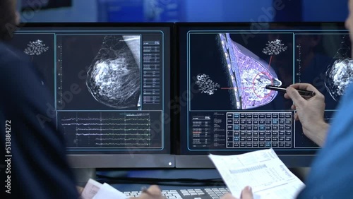 Breast Cancer Diagnosis