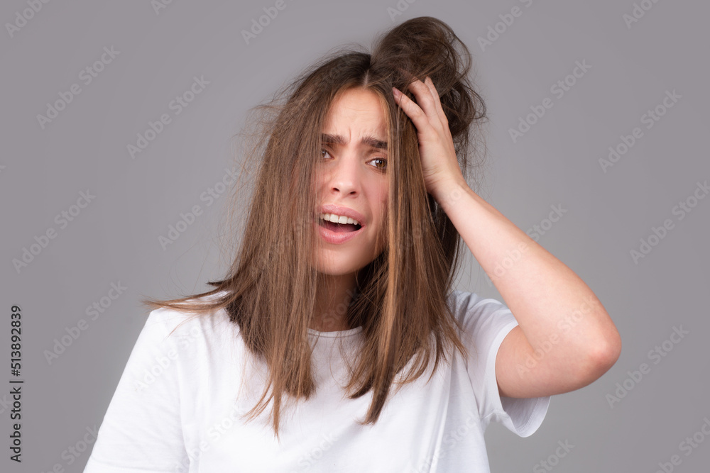 Woman hair loss problem, baldness of the head. Health care shampoo and beauty product concept. Woman hair loss problem, baldness of the head. Health care shampoo and beauty product concept.