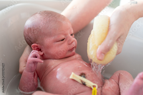 hands of a mother bathing her little newborn baby with a soft sponge and warm water, with the umbilical cord clamp still attached photo