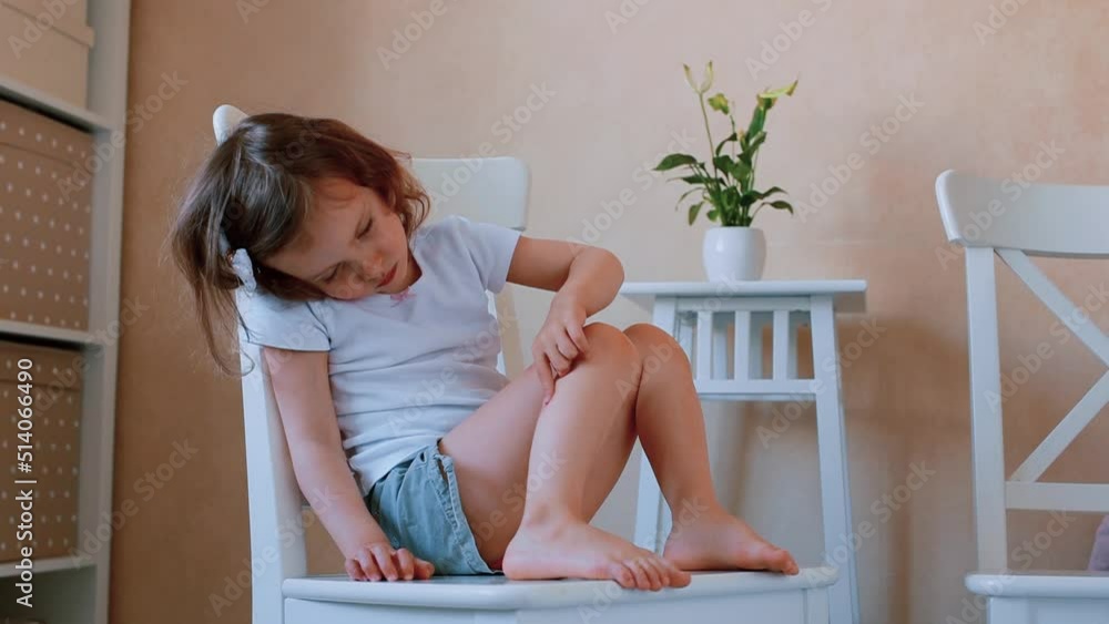 A child bitten by insects applies cream to wounds. First aid for allergy A child bitten by insects applies cream to wounds. First aid for allergy