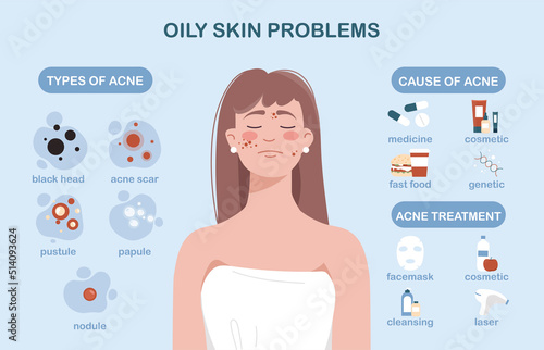 Oily skin problems. Set of problems, their causes and cures. Health care, proper nutrition and cosmetics with preparation to combat wrinkles, black dots and acne. Cartoon flat vector illustration