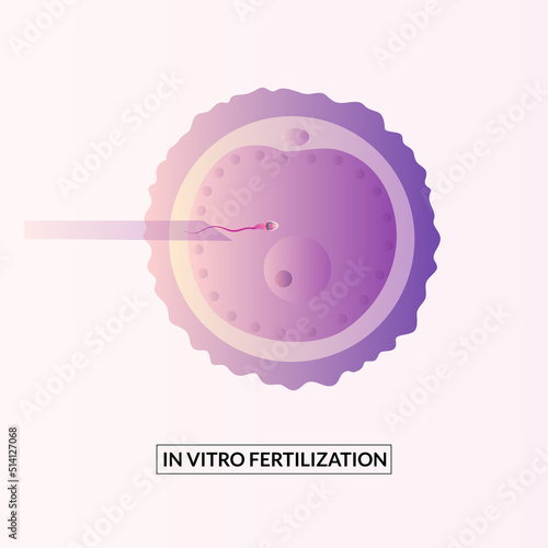 In vitro fertilization concept. Artificial insemination and pregnancy.